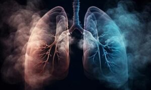 Lung Cancer Surgery for Non-Smoking Patients Smoking Increase Lung Cancer