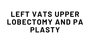 VATS Upper Lobectomy