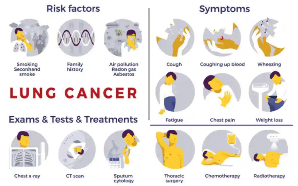 Lung Cancer Symptoms
