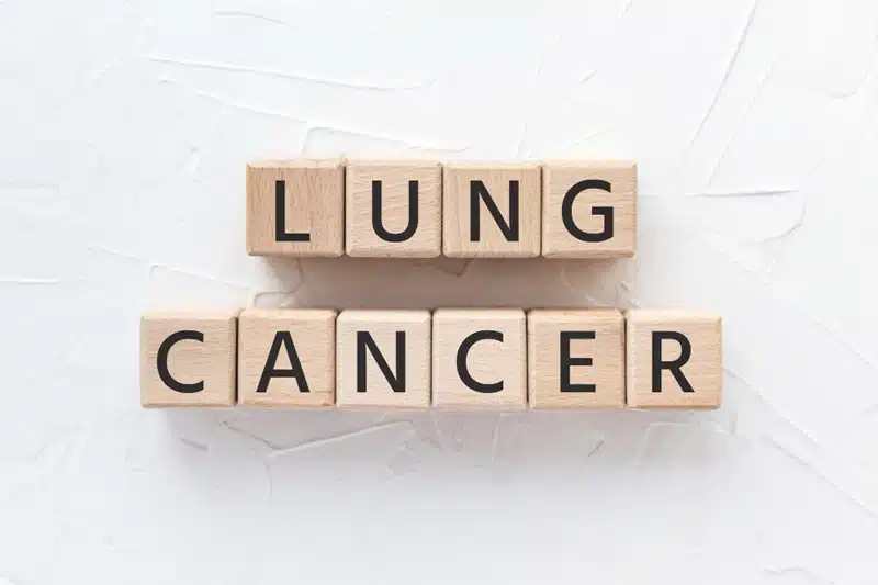 Lung cancer treatment by stage explained