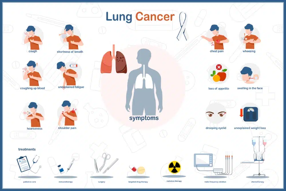 Lung Cancer Surgery- What to Expect