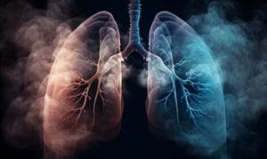 Smoking Increase Lung Cancer