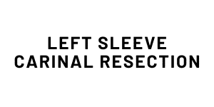 Left Sleeve Carinal Resection