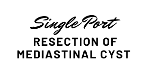 Single Port Resection of Mediastinal Cyst