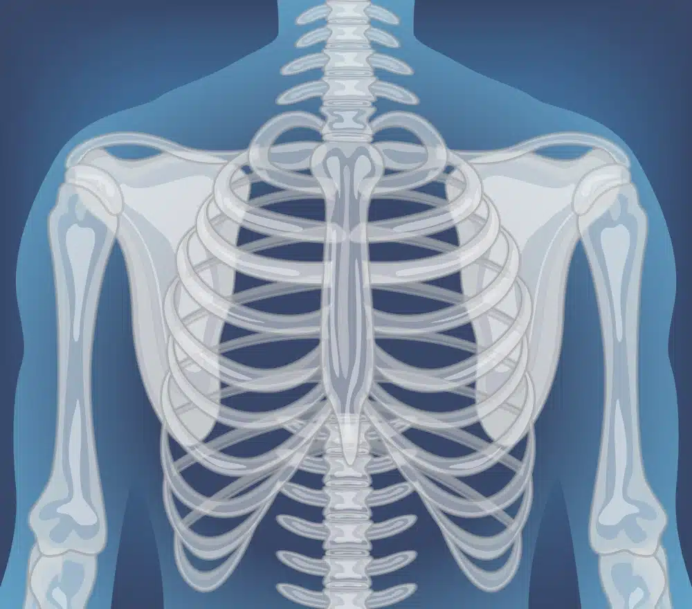 Xray-of-human-body