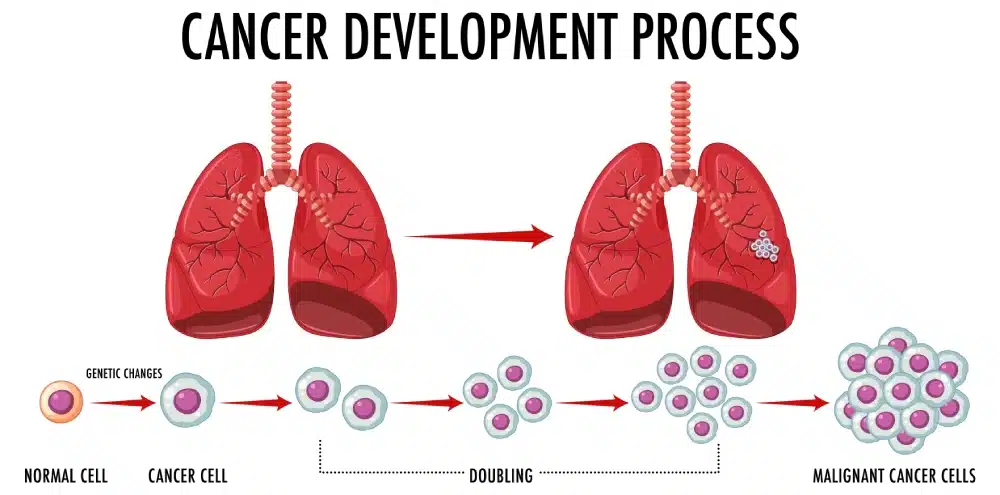 Cancer development process