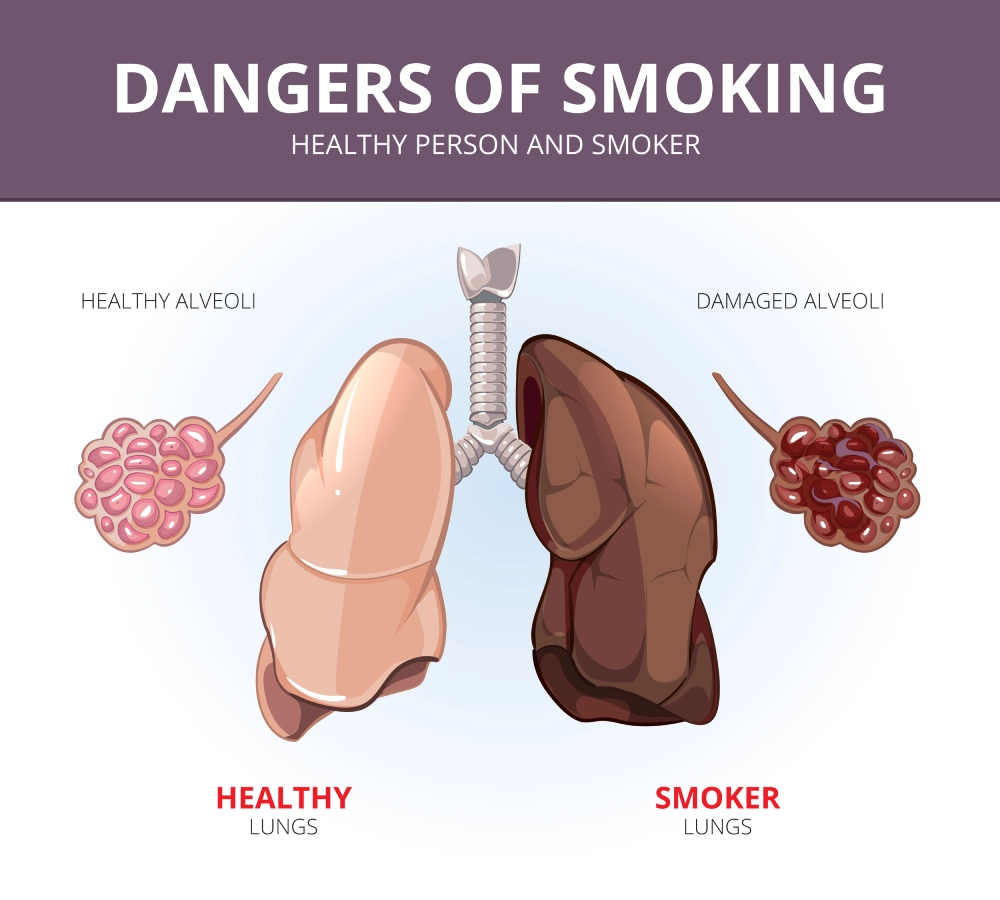 Illustration of lungs and alveoli of a healthy person and smoker
