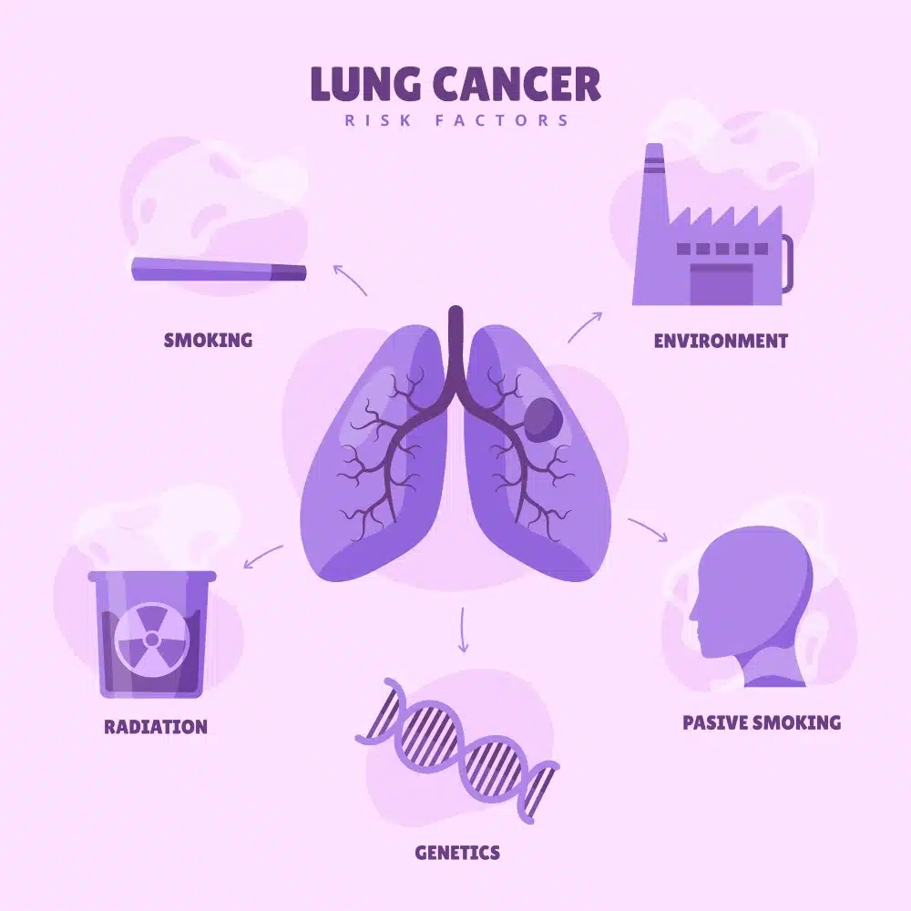 Lung cancer risk factors