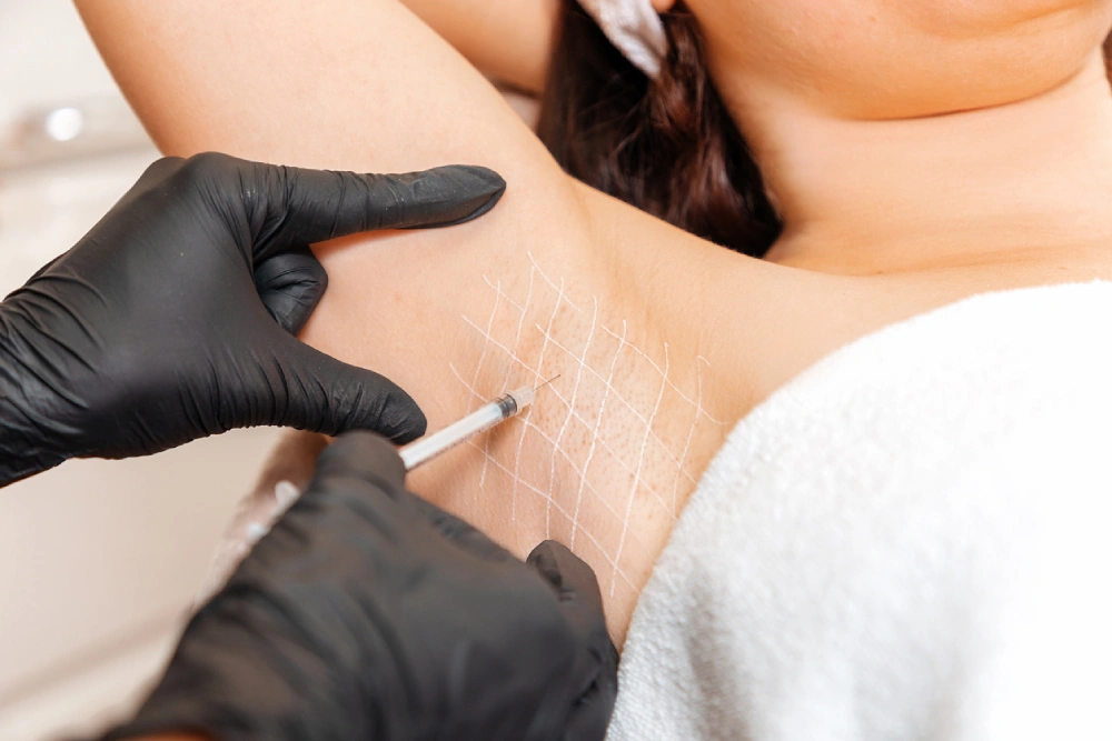 Treatments for excessive underarm sweating