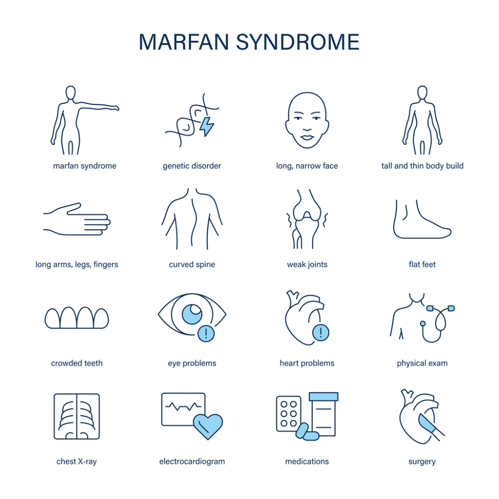 marfan syndrome