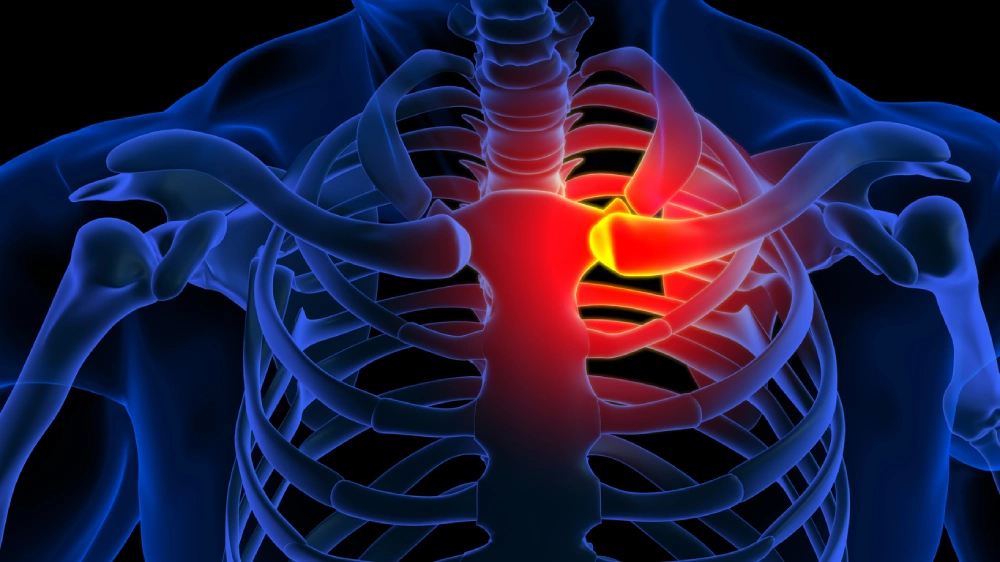 rib pain illustration