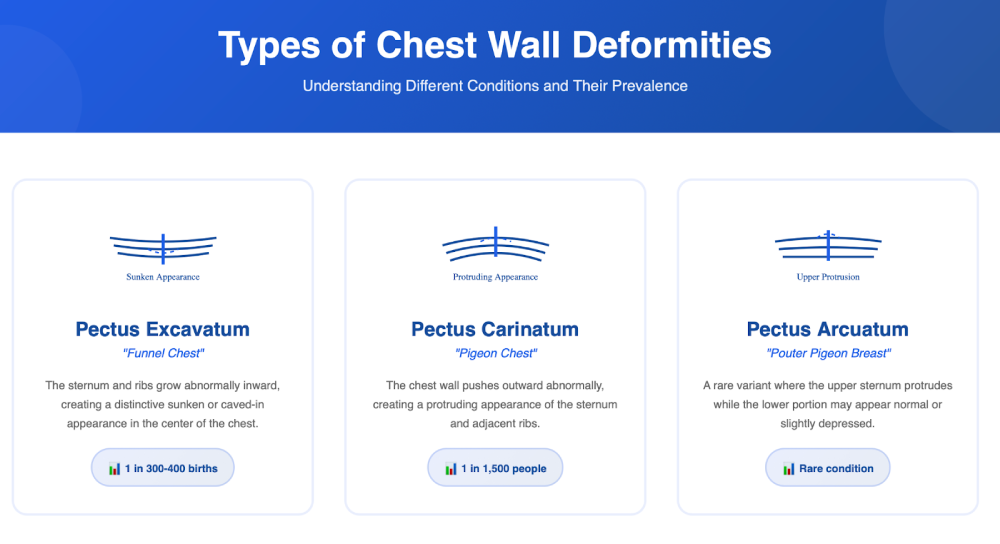 Understanding and Treating Chest Wall Deformities: Your Complete Guide to Pectus Excavatum, Pectus Carinatum, and Other Conditions 1 types of chest wall deformities