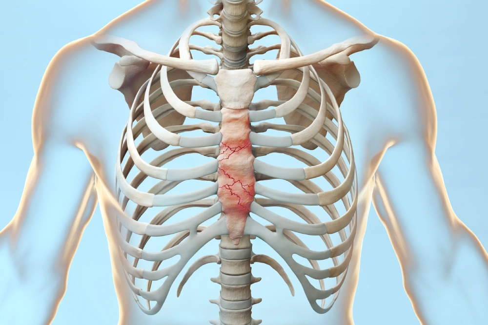 Anatomy of Sternal Fractures