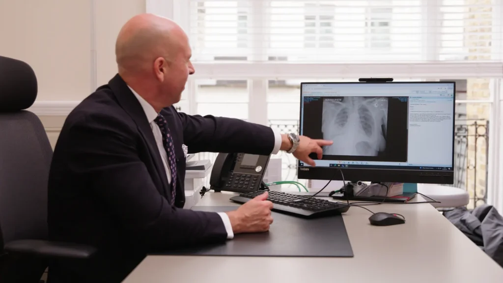 Thoracic surgeon explaining CT scan results to a patient