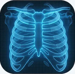 Rib Fractures 2 Glowing blue ribcage on dark grid background
