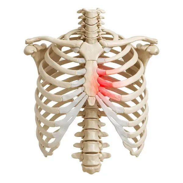 Human ribcage with red-highlighted ribs showing chest and rib pain.