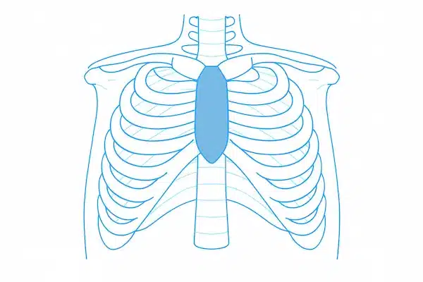 Chest Wall Deformities 2 Simplified anatomical illustration of the rib cage and sternum, useful for explaining pectus excavatum structure.