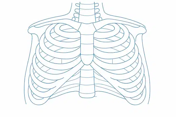 Chest Wall Deformities 1 Line drawing of a human rib cage showing the sternum and ribs, useful for illustrating pectus excavatum anatomy.