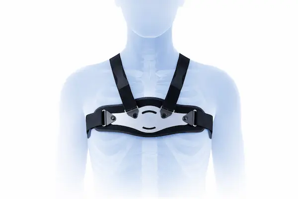 Chest Wall Deformities 5 Digital illustration of a person wearing a chest brace applying compression to the front of the ribcage, shown in a way that helps compare bracing concepts with treatments used for pectus excavatum.