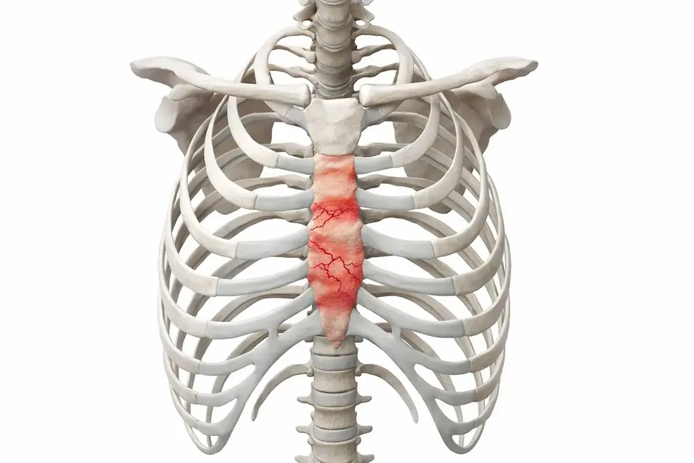 Anatomy of Sternal Fractures