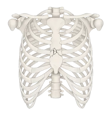 Sternal fractures 3 e1773221785224