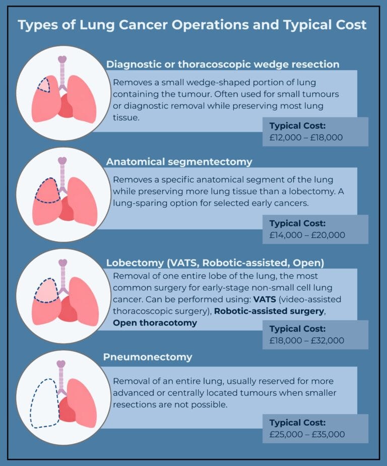 How Much Does Lung Cancer Surgery Cost in the UK?