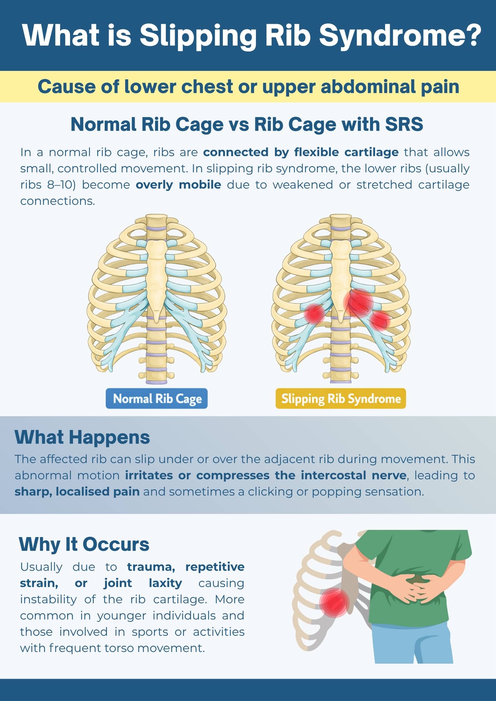 Slipping Rib Syndrome: Which Ribs Are Affected and Complete Treatment Guide 1 Slipping Rib Syndrome, SRS infographic