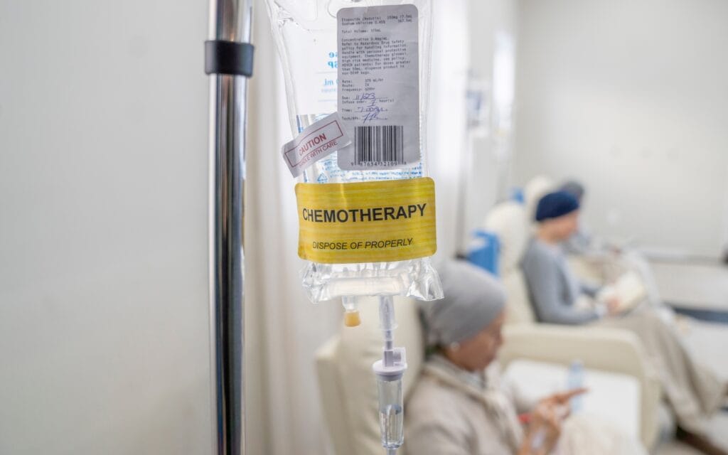 When Is Chemotherapy Recommended After Lung Cancer Surgery? 1 Chemotherapy