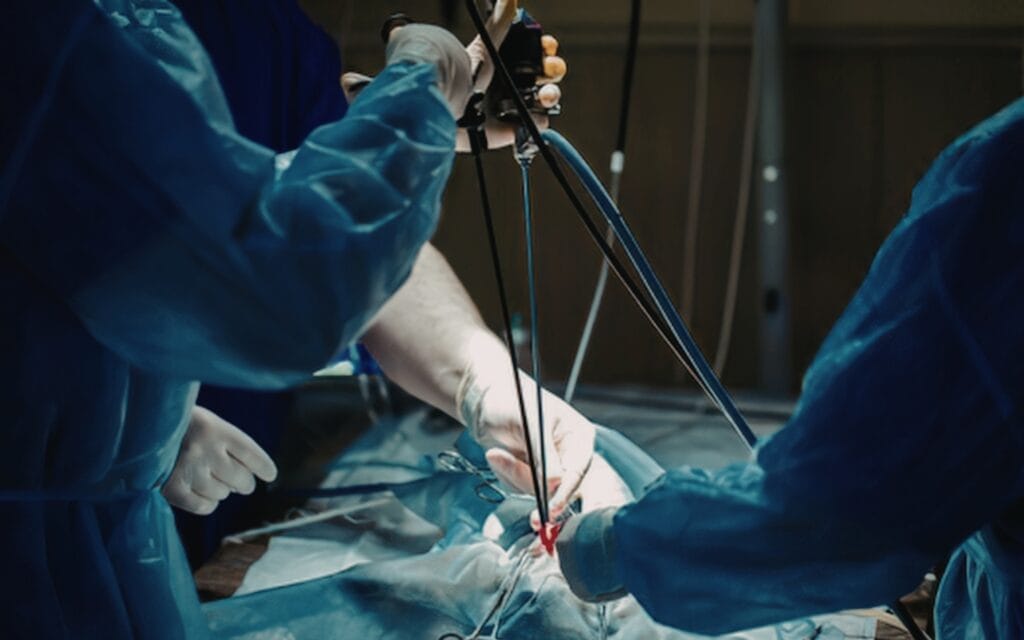 What Is Minimally Invasive Thoracic Surgery and How Does It Work? 3 Minimally Invasive Surgery uk