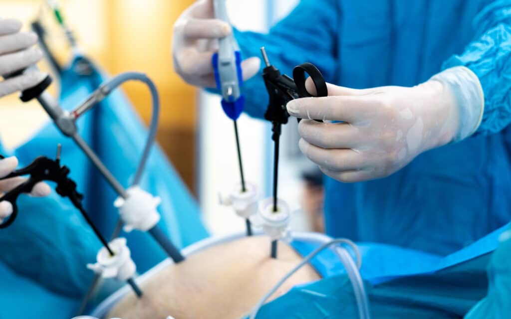 Minimally Invasive Thoracic Surgery