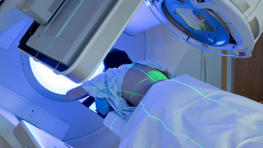 Radiotherapy