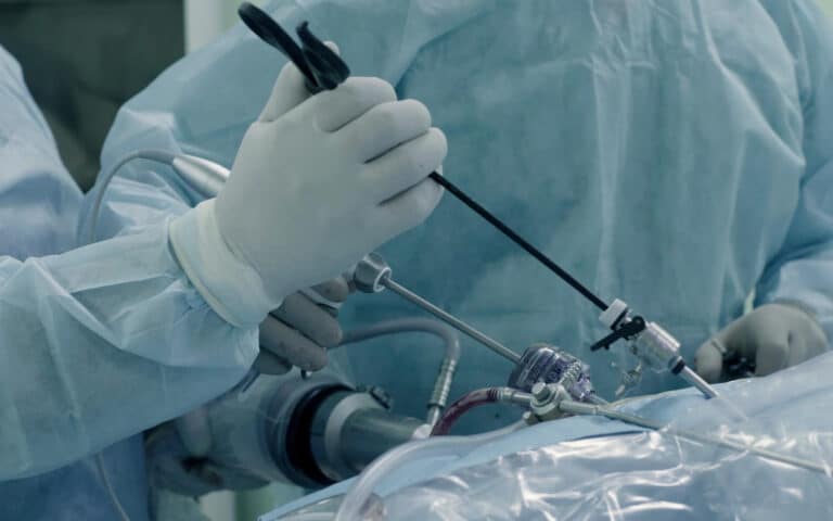 Advances in Thoracic Surgery Technology in Recent Years