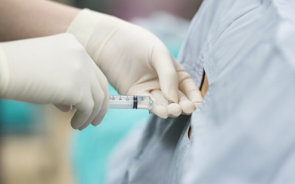 Advances in Thoracic Surgery Technology in Recent Years 3 Modern Approaches to Pain Control and Analgesia