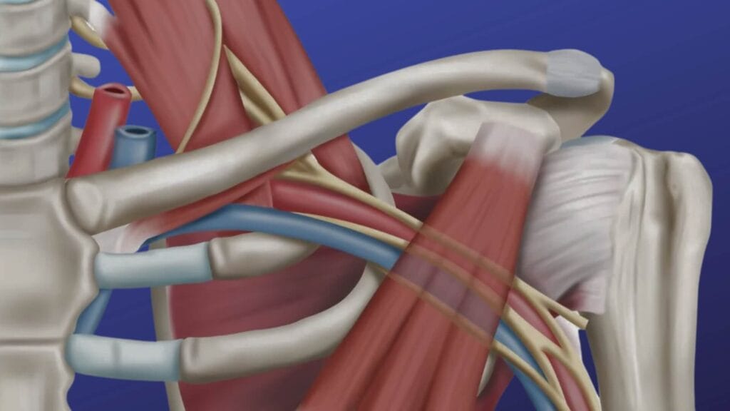 Thoracic Outlet Anatomy