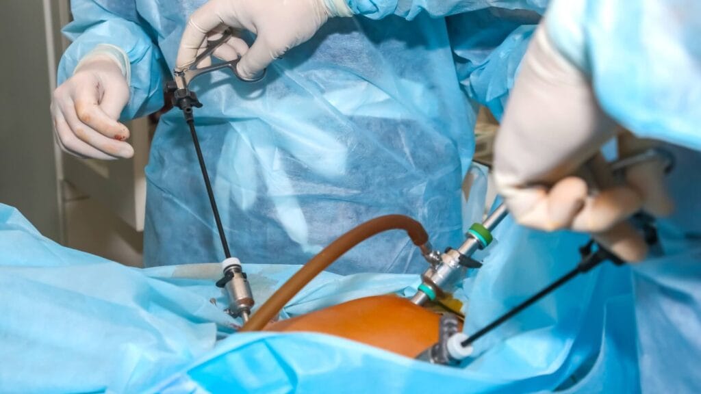 What Is Lung Keyhole Surgery and Who Is It For?
