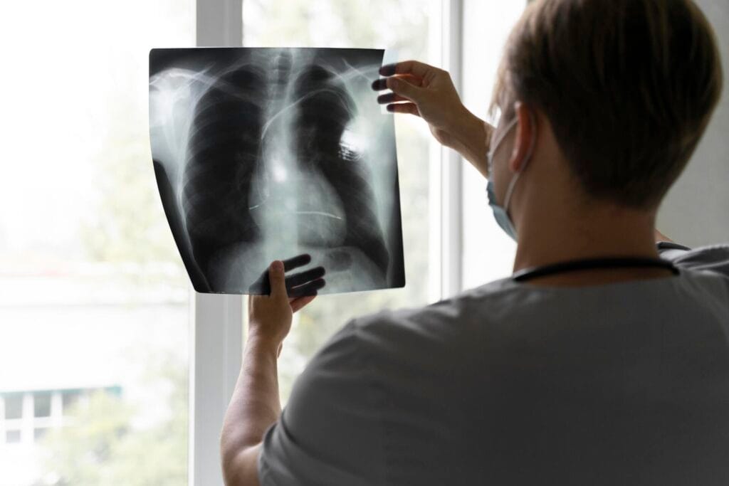 How Are Rib Fractures Diagnosed After a Cough?