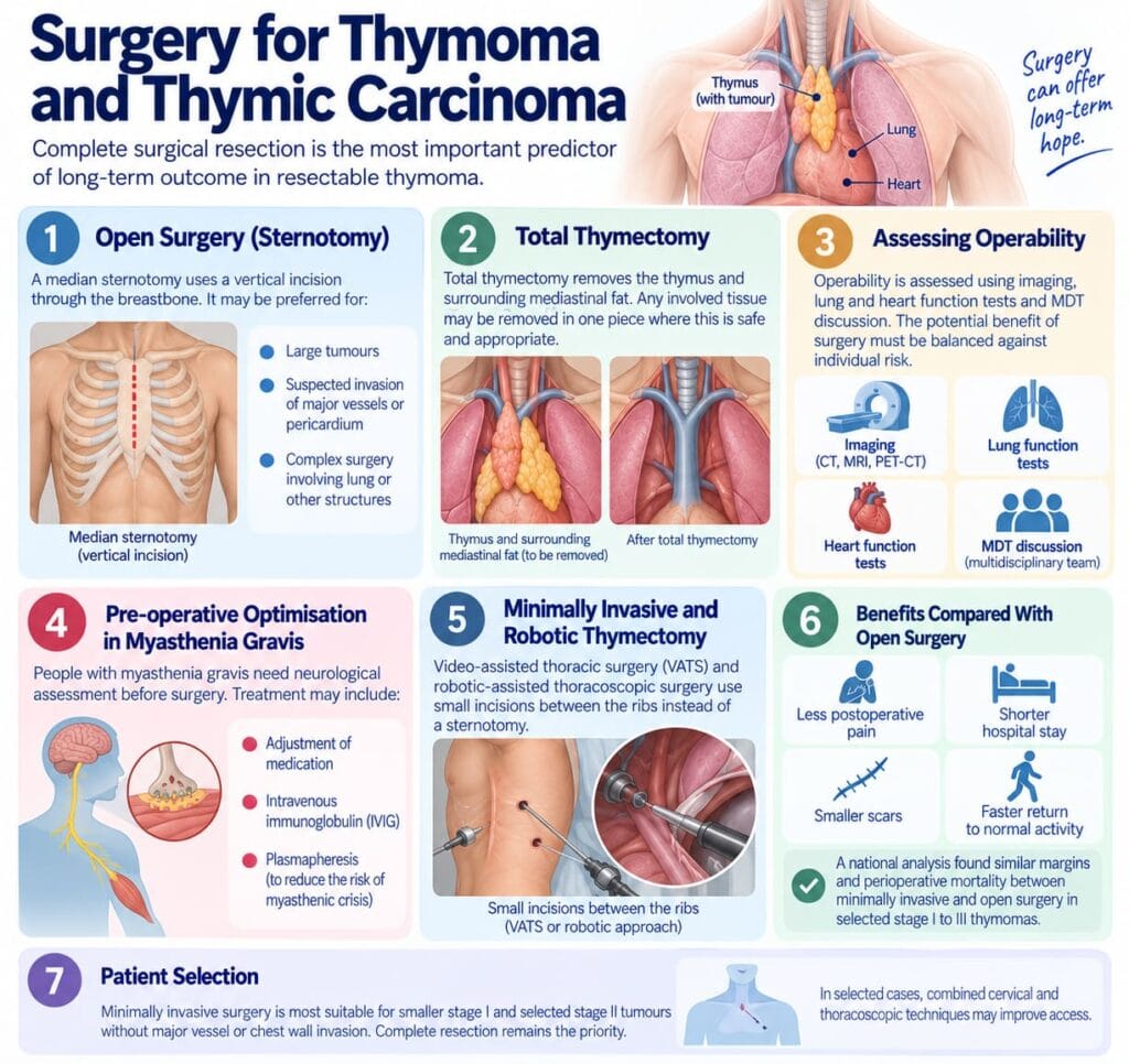 What Is Thymoma Cancer? Causes, Symptoms and Treatment Options 2 Surgery for Thymoma and Thymic Carcinoma