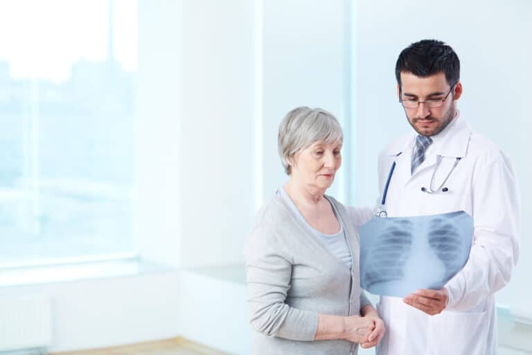 Lung Cancer Stages: From First Diagnosis to Post‑Surgery Staging