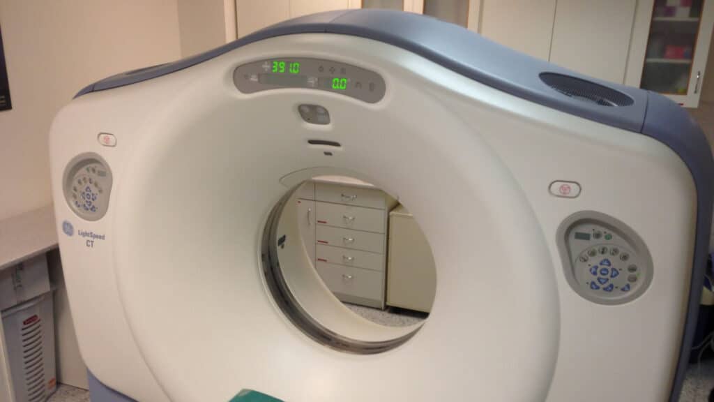Can a Lung Nodule Turn into Cancer? Understanding Risk, Testing and When to Worry 3 The Role of PET CT: Metabolic Clues to Malignancy
