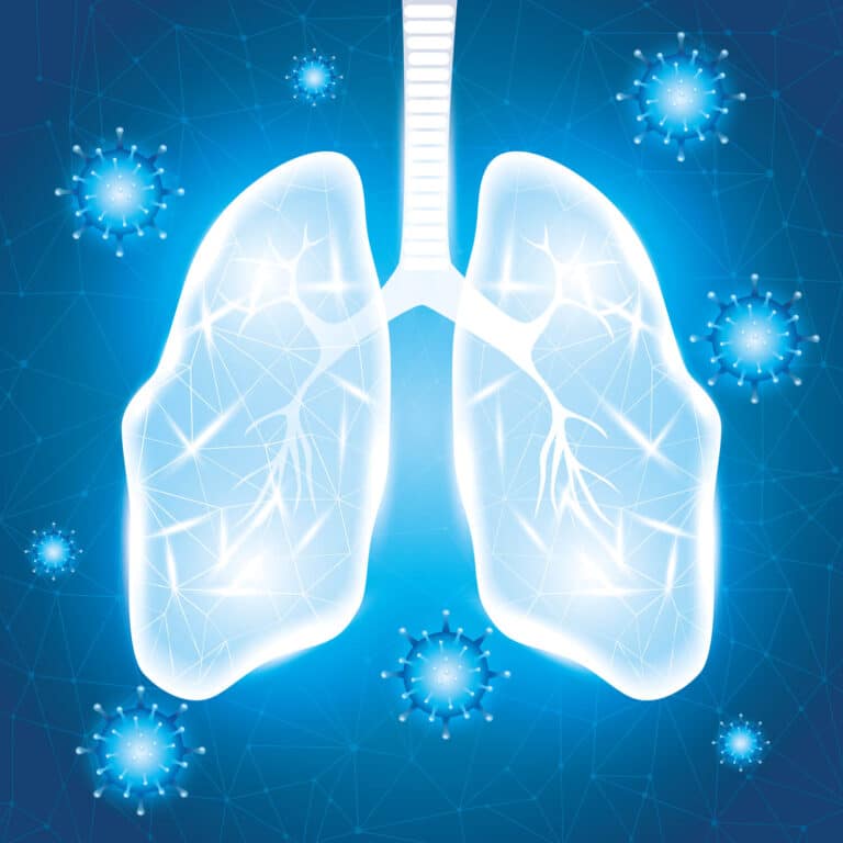 Lung Cancer and Pneumonia: What to Do When They Occur Together