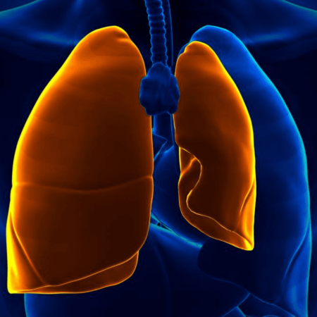 Pneumothorax Therapy